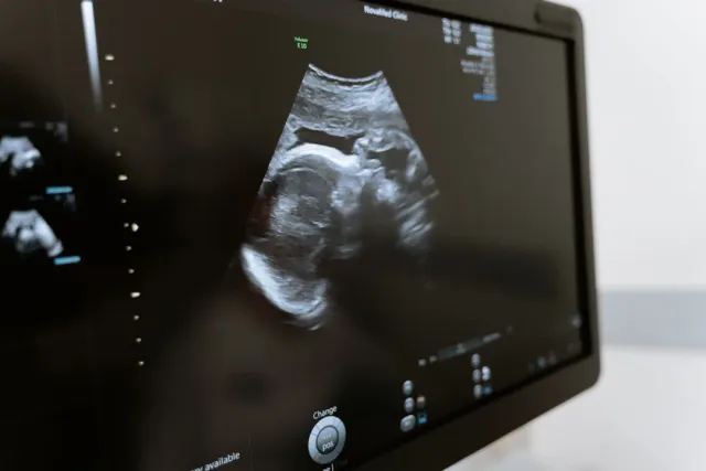 Ultrasound examination